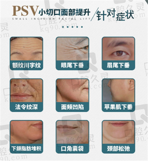 李晓东PSV面部提升针对症状