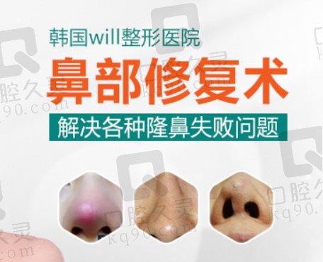 韩国WILL整形外科鼻修复情况