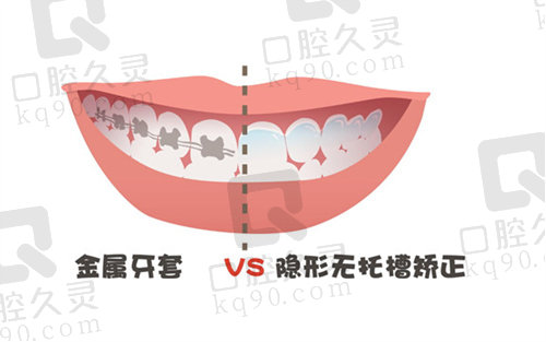 深圳牙齿矫正一般需要多少钱