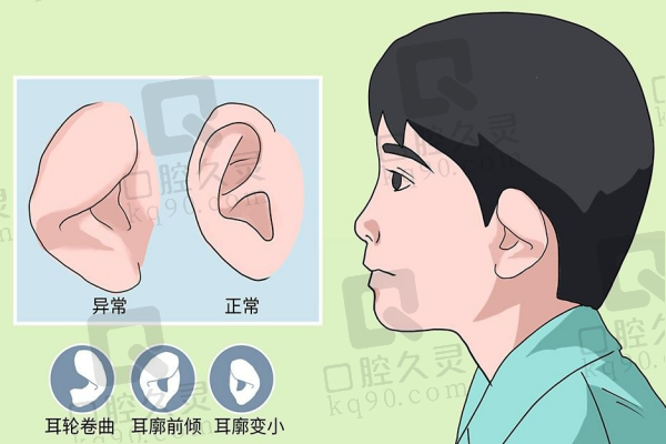 郭树忠耳再造很不错