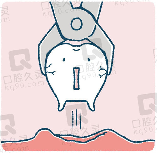 牡丹江张月鹏口腔诊所拔智齿多少钱