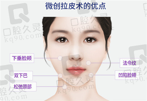 杜太超面部拉皮