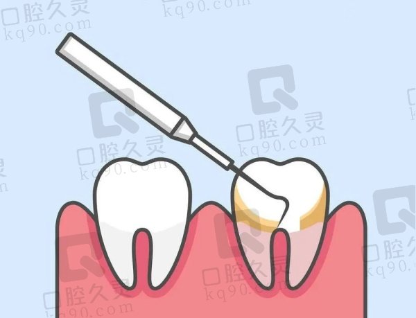 株洲优伢仕口腔医院其他牙科价格表