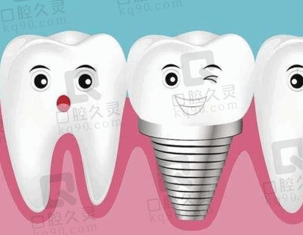 衡水可恩口腔医院韩国Neo种植牙价格