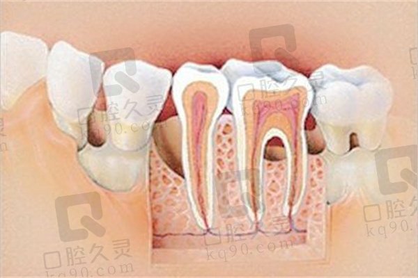 牙根坏了牙齿松动怎么办