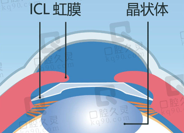 眼睛结构示意图