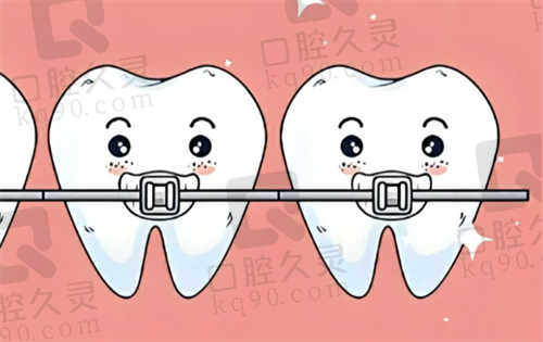 浙江矫正牙齿多少钱