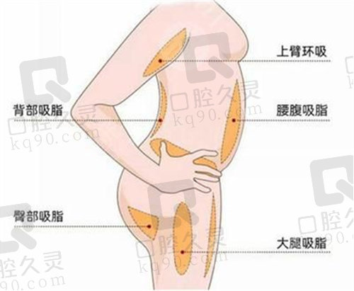 上海华美整形医院好吗？