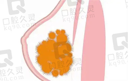 黎星取生长因子价位