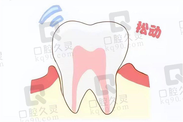 牙齿用手掰有轻微晃动