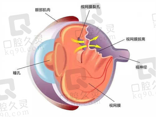 成都华厦眼科医院特色项目.jpg