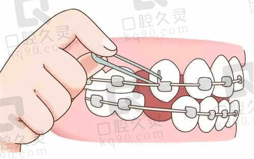 西安雁塔小白兔口腔医院特色项目