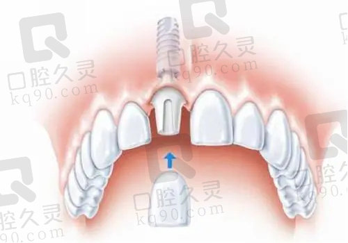 长沙雅贝康口腔医院怎么样？