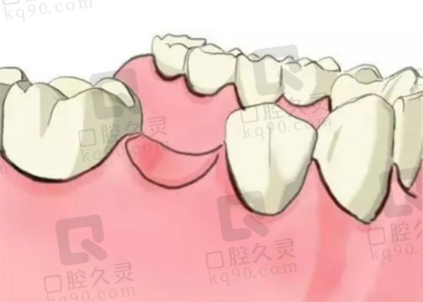 唐山镶牙价格