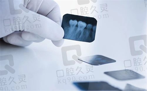 烟台欢乐口腔医院金属矫正5980元起,王海任医生技术娴熟