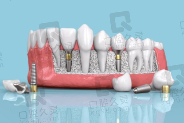 海门种植牙哪家医院好