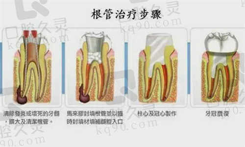 简阳圣贝口腔门诊部项目价格表