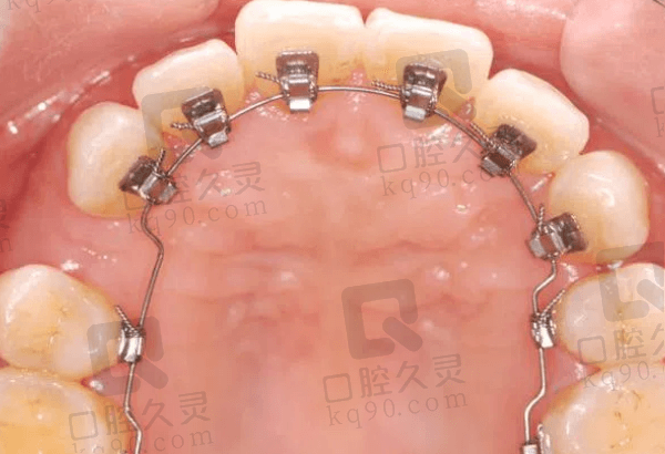 广州圣贝口腔牙齿矫正怎么样