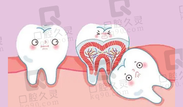 埋伏牙和阻生牙均有可能影响其它牙齿健康