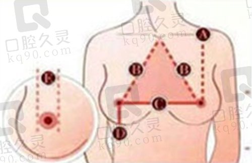 赵绛波医生缩胸手术