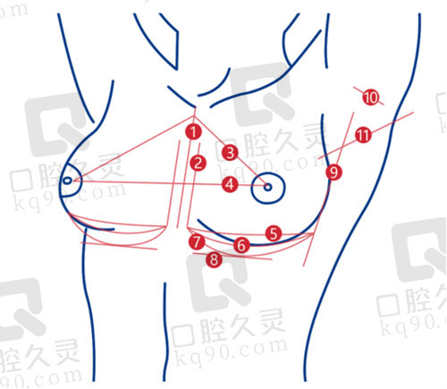 北京纯脂孙泽芳医生5C脂肪艺术丰胸技术优势