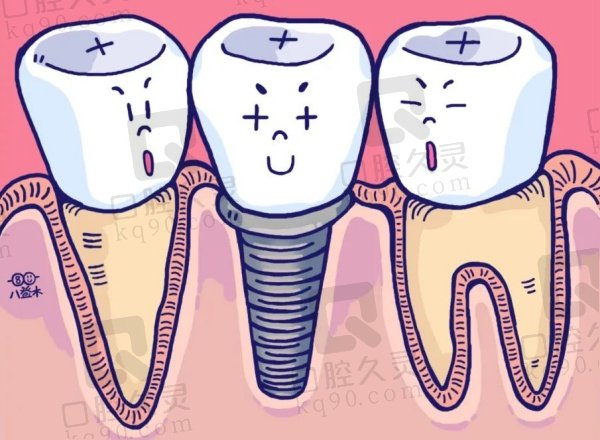 深圳尔睦口腔医院种植牙价格表