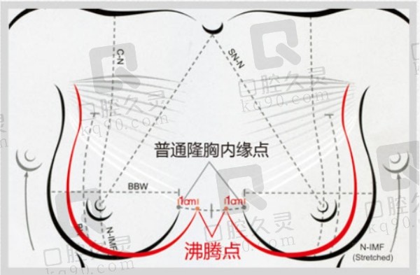 林沸腾医生内窥镜隆胸怎么样