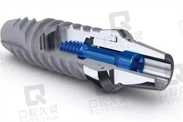 北京瑞泰口腔丰台分院种植牙怎么样