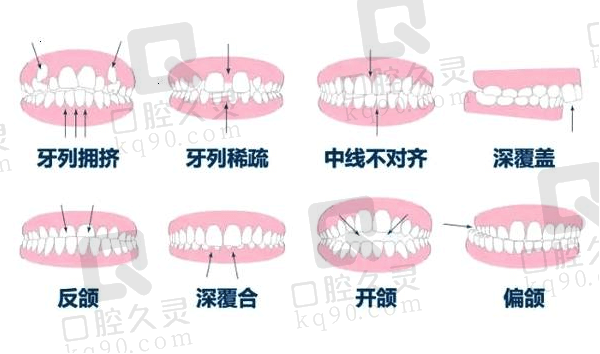 泉州牙齿矫正哪家医院好？