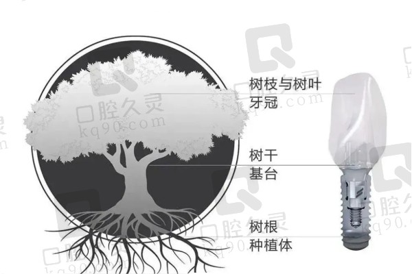 种植牙一千多和几千的区别是什么？