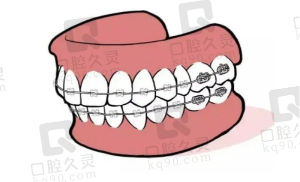 天津君诚口腔矫正价格表