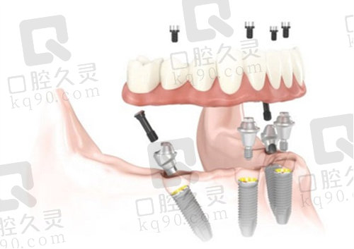 深圳乐孚新安口腔门诊部环境