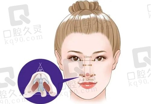 深圳艺星牛克辉医生做鼻子怎么样？