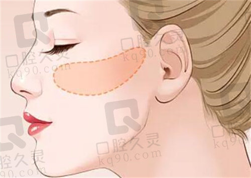 成都东篱医院磨骨哪个医生好？
