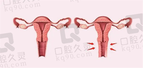 西安国医付丹凤医生4D生物束带价格