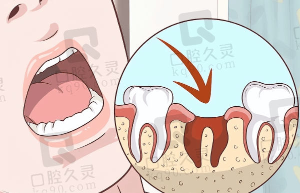 日照牙科医院牙齿矫正多少钱？