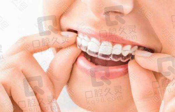 郑州牙科牙齿矫正价格表 郑州牙科牙齿矫正价格表