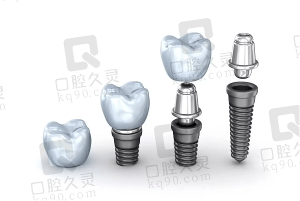 种植牙的价格差异：