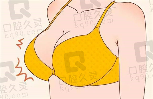 成都畫美趙敬國醫(yī)生Real復(fù)合隆胸價格