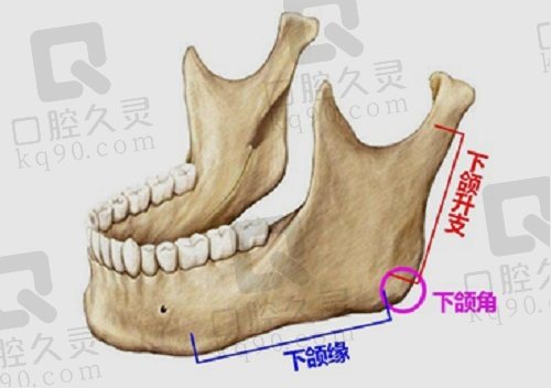 北京圣嘉新张笑天医生下颌角磨骨术