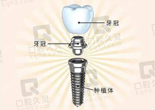 徐州惠雅口腔