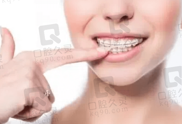 杭州英博口腔牙齿矫正价格