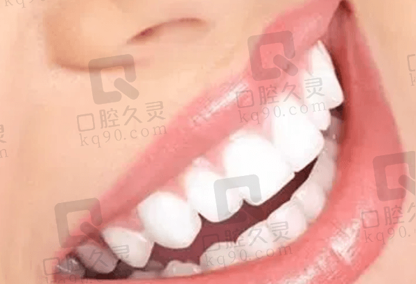 杭州英博口腔牙齿美白价格