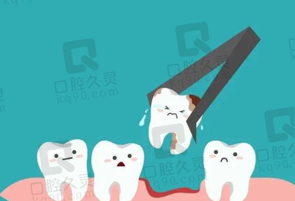 苏州拔牙能用医疗保险吗