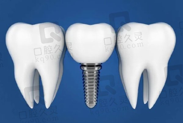 焦作军美口腔医院种植牙价格