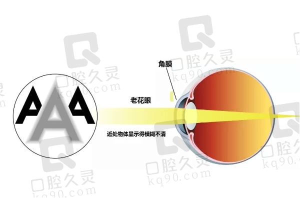 40岁，能和近视眼可以配一副眼镜吗？