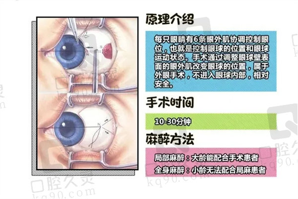 青少年斜视手术有没有必要做