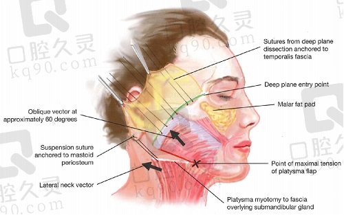 北京加减美面部提升怎样？