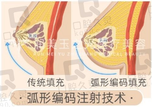 王明利医生做脂肪填充好吗？