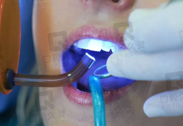 北京牙元素口腔美国冷光牙齿美白660元起